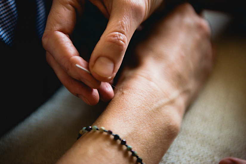 zabiegi medycyna chińska